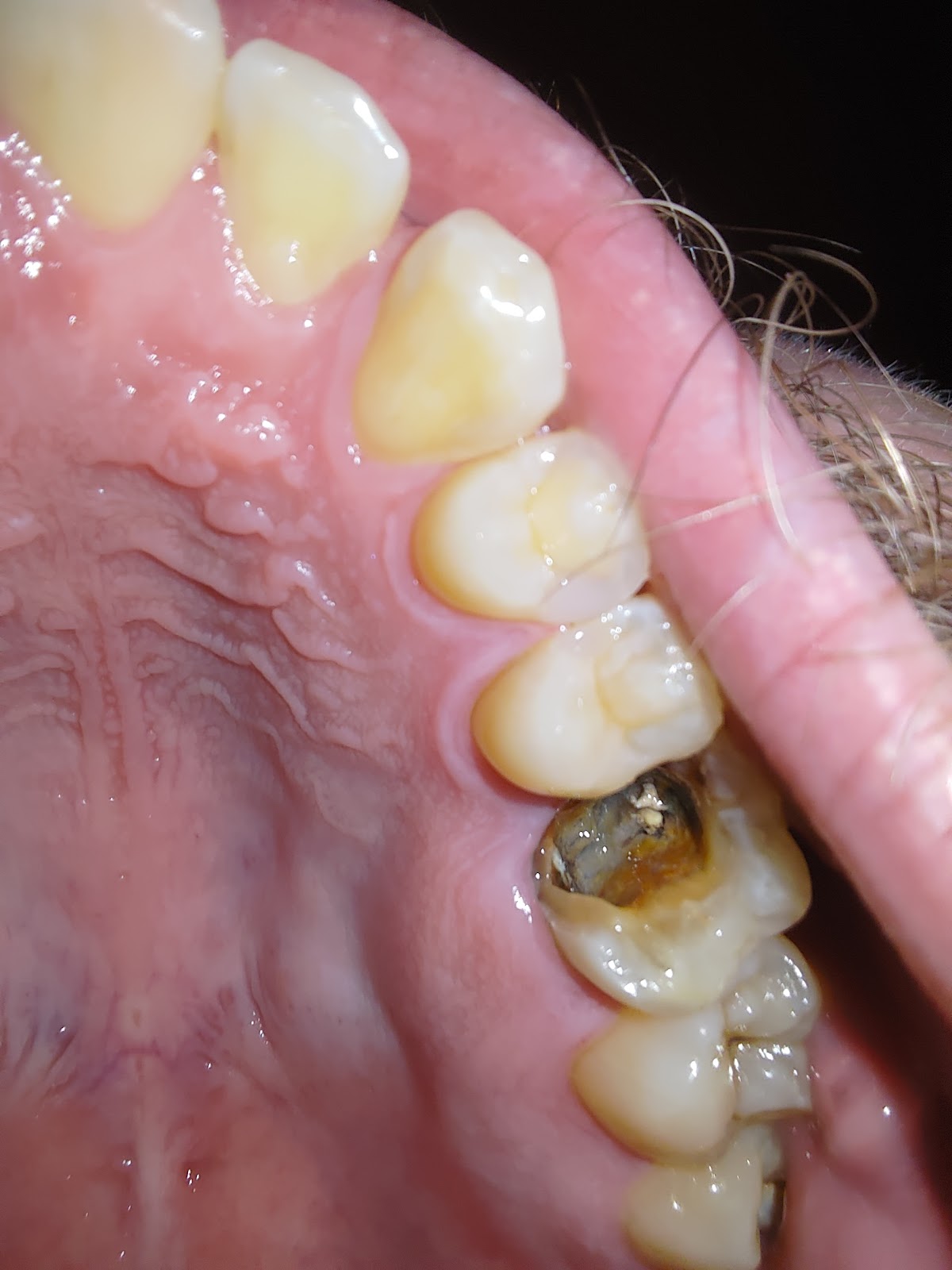 gp_6a487ab29e735