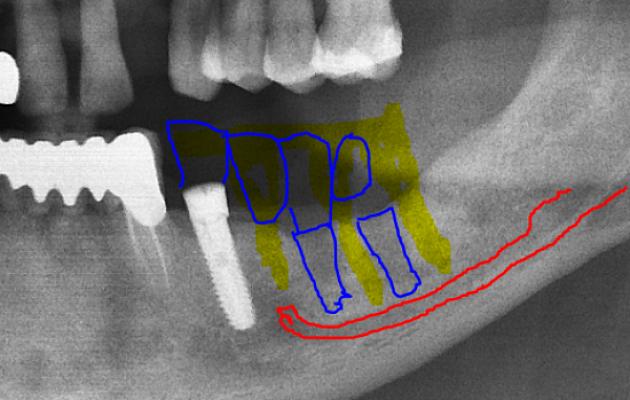 gp_6a487277cbcf3